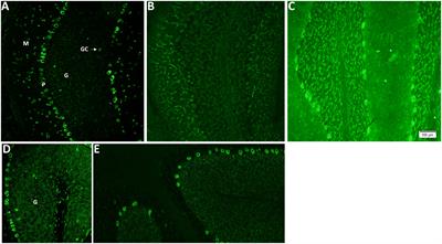 CDR2 and CDR2L line blot performance in PCA-1/anti-Yo paraneoplastic autoimmunity